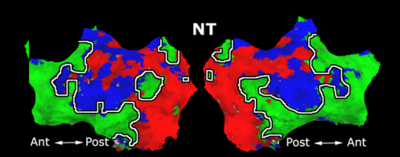 Mit fmri clustering parcellation3 shb7.png