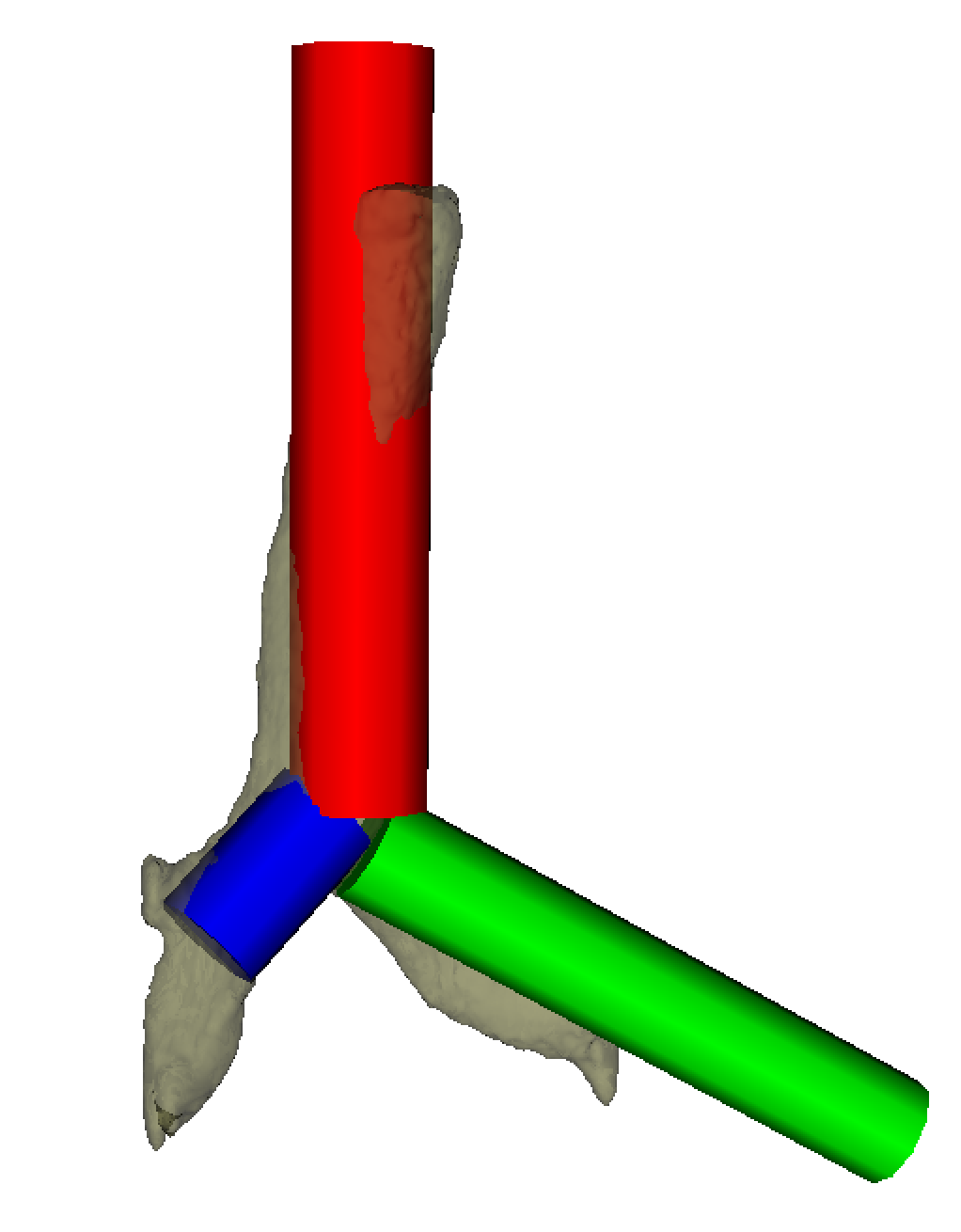 Trachea Stent Planning