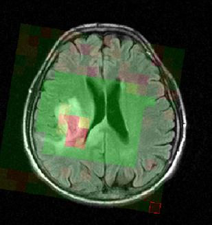 File:Mrsi slicer.jpg