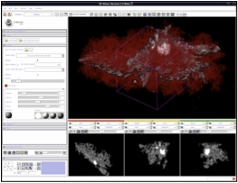 File:Slicer Astrocyte.jpg