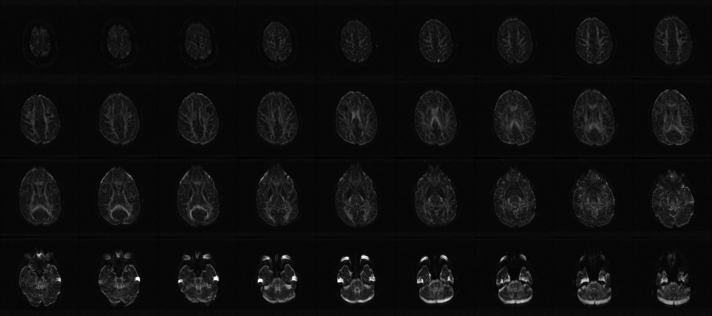 DWI registration reduces ghost anisotropy