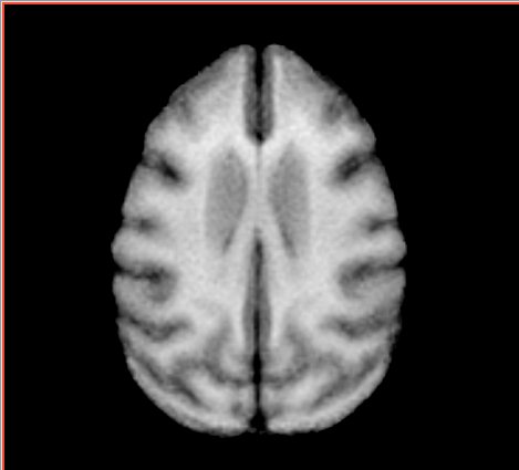 File:Atlas axial.jpg