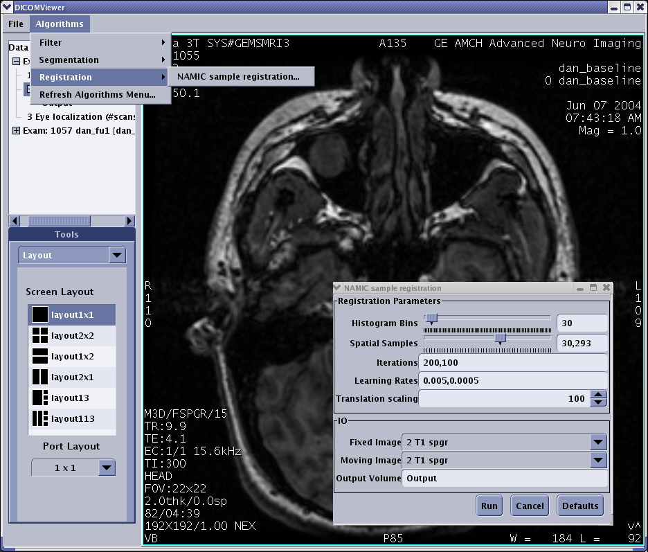 Sample GUI generated from XML above