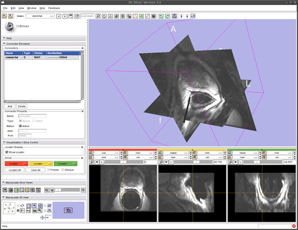 OpenIGTLink Slicer Screenshot.png