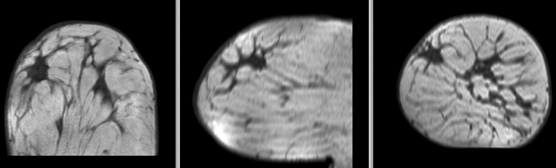 File:RegLib C06b BSpline1 deformation masked.gif