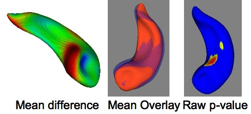 ShapeAnalysisOverviewStatsHippo05.jpg