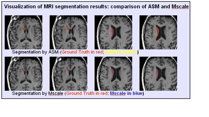 File:Gatech SW caudate seg.png