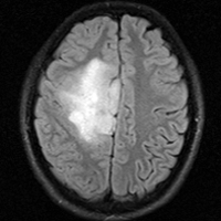 File:RegLib27 FlAIR.png