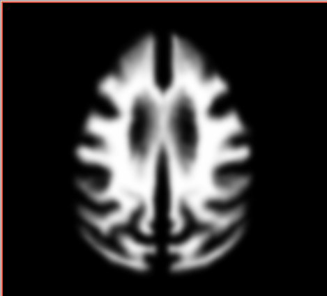 File:Atlas wm axial.jpg