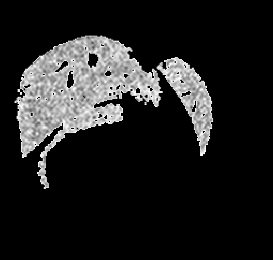 File:LiverDiffMRI Segmented.png