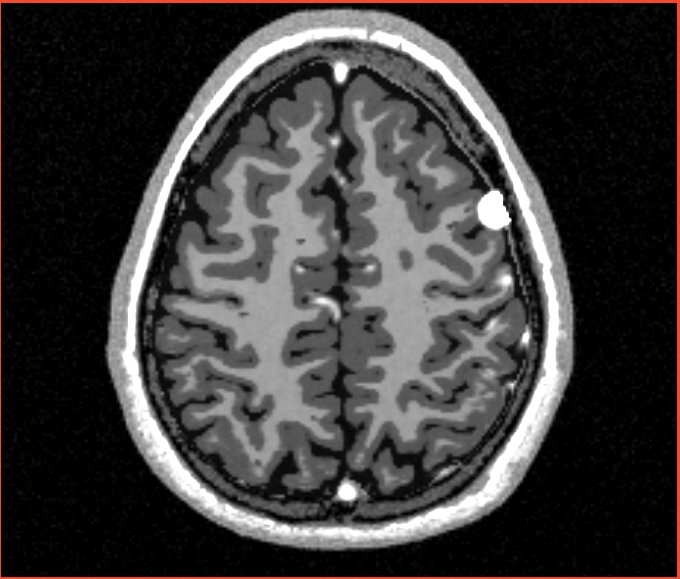 File:Ts rc4 p0.5.jpg