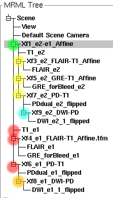 MRML tree hierarchy. The T1_e1 image is the main reference. T1_e2 is the intermediate reference for exam 2