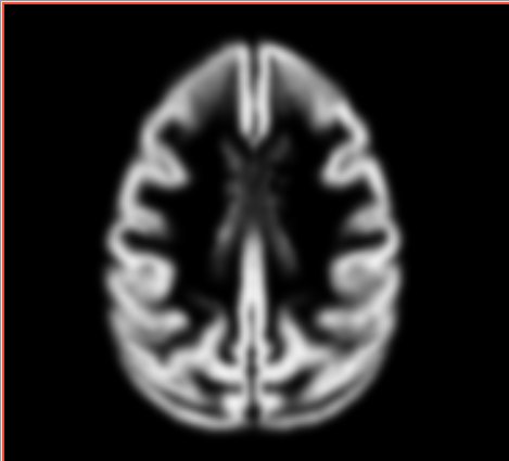 File:Atlas gm axial.jpg