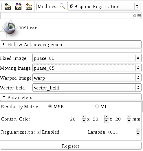 File:Plastimatch loadable bspline gui 2012.png