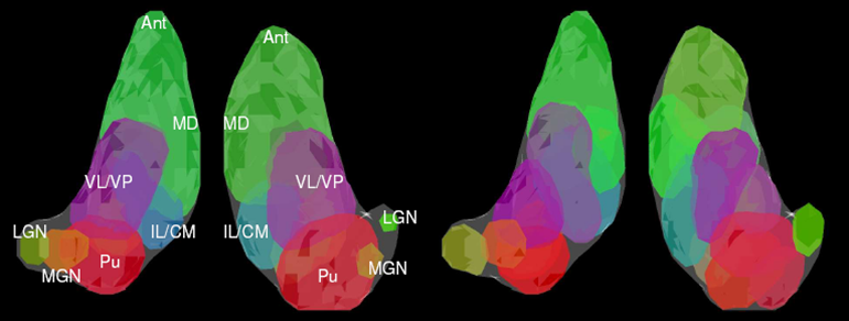 Thalamus results.png