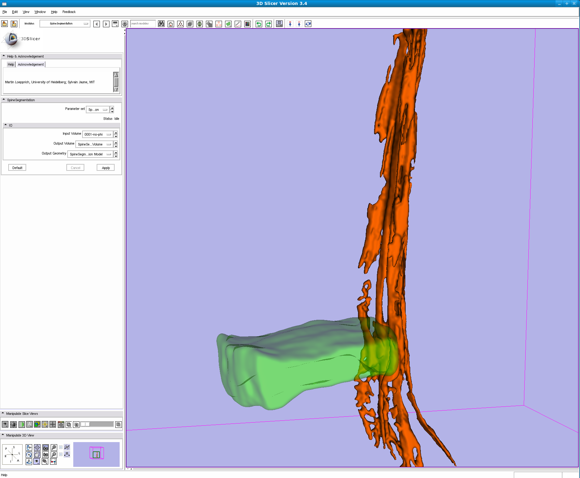 Results of the SpineSegmentation module in Slicer 3.5