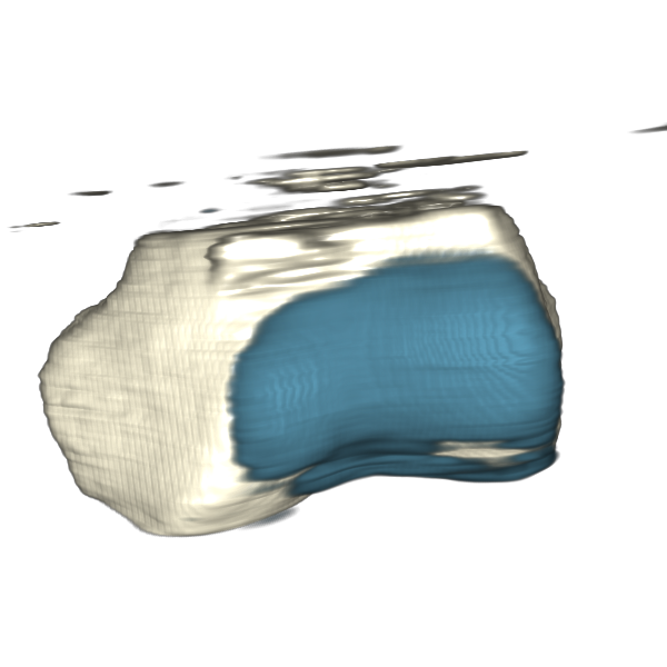 3d rendering of femur with cartilage