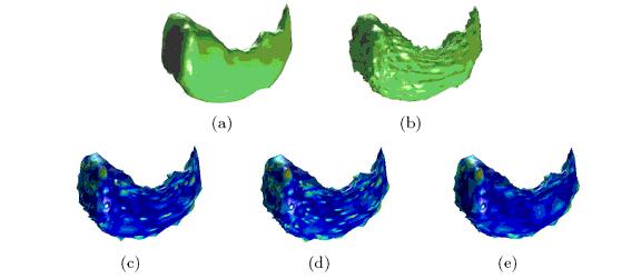 Left Hippocampus Denoising