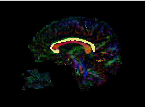 Slice-wise view of CB Segmentation result
