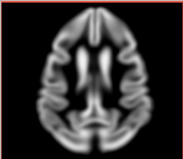 File:Calvin atlas demo rhesus gm.jpg