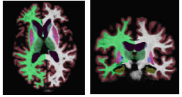 Segmentation example2.png