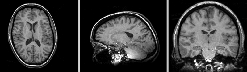 File:RegLib C19 AGif BSplDef.gif