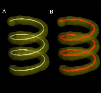 Tracts Segmenting Helix Phantom