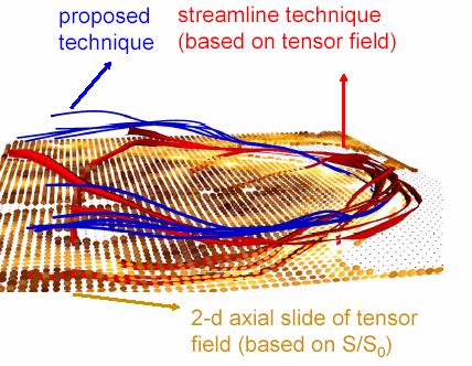 Figure 2: Comparison of technique with streamline based on tensor field.