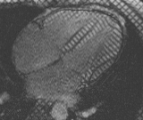 File:Tagged MRI LA.png