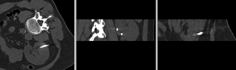 File:RegLib C17 manualInit.gif