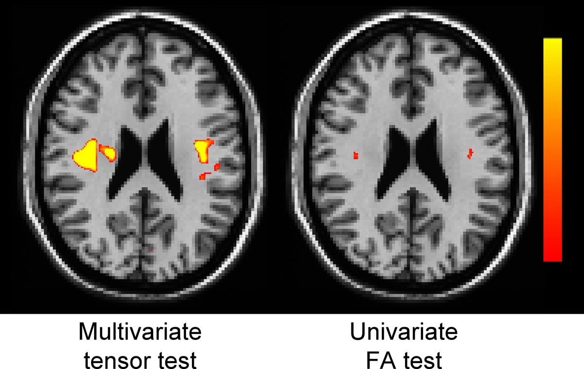 Multivariate vs. Univariate Test Comparison