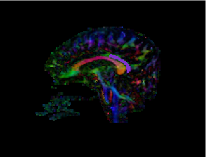 Slice-wise view of CB Segmentation result