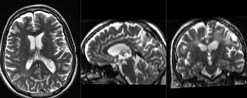 File:RegLib C03 baseline registered.gif