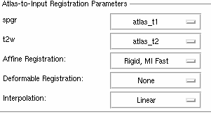 Projects-ARRA-SlicerEM-EMSegment widget 8 AtlasToInputRegistration.png