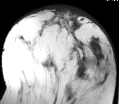 File:RegLib C06 BreastMRIPreRx.png