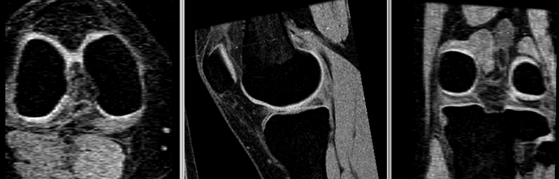 File:RegLib C21 BSpline.gif