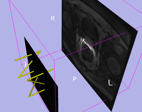 SummerProjectWeek2009 ZFrameScreenshot.png