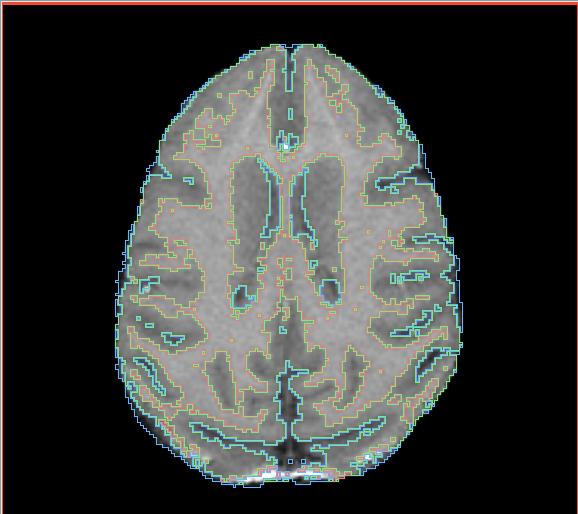 File:Calvin EMSegment.jpg