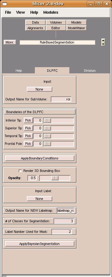 DLPFC Slicer Module