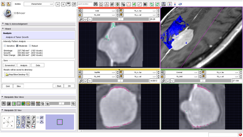 File:ChangeTracker Analysis.png