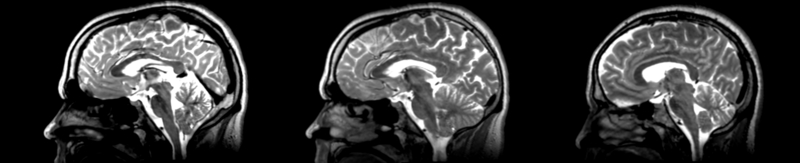 File:53-31 RI rigid.png