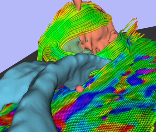 Visualization of peritumoral diffusion streamlines in 3D Slicer