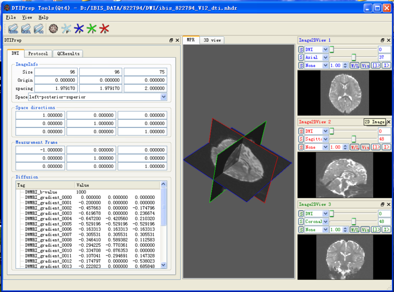 File:DTIPrep-gui.png