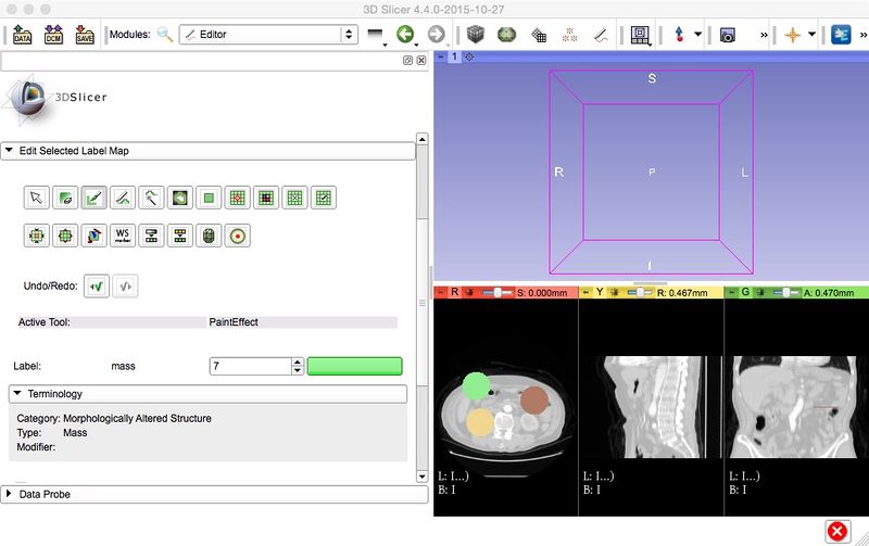 File:Slicer45-terminology widgets.jpg