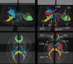 Quantitative Tractography