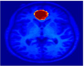 Mit fmri clustering Seed vACC.jpeg