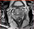Thumbnail for version as of 22:59, 15 June 2010