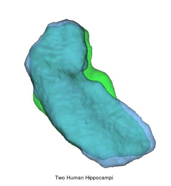 File:Atlas target.jpg