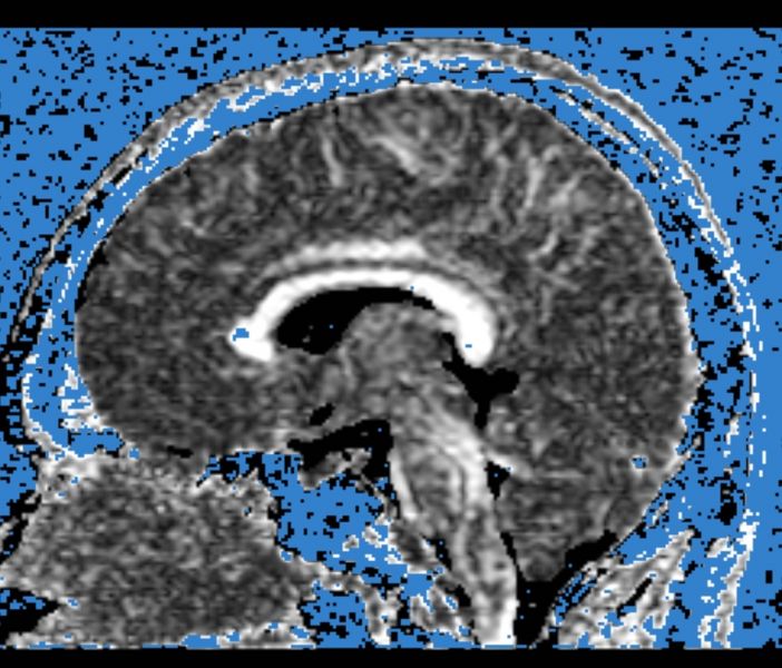 File:CaseD100 A1.jpg