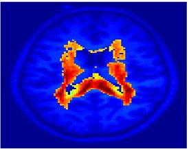 Mit fmri clustering KM 5Clust 5.jpeg